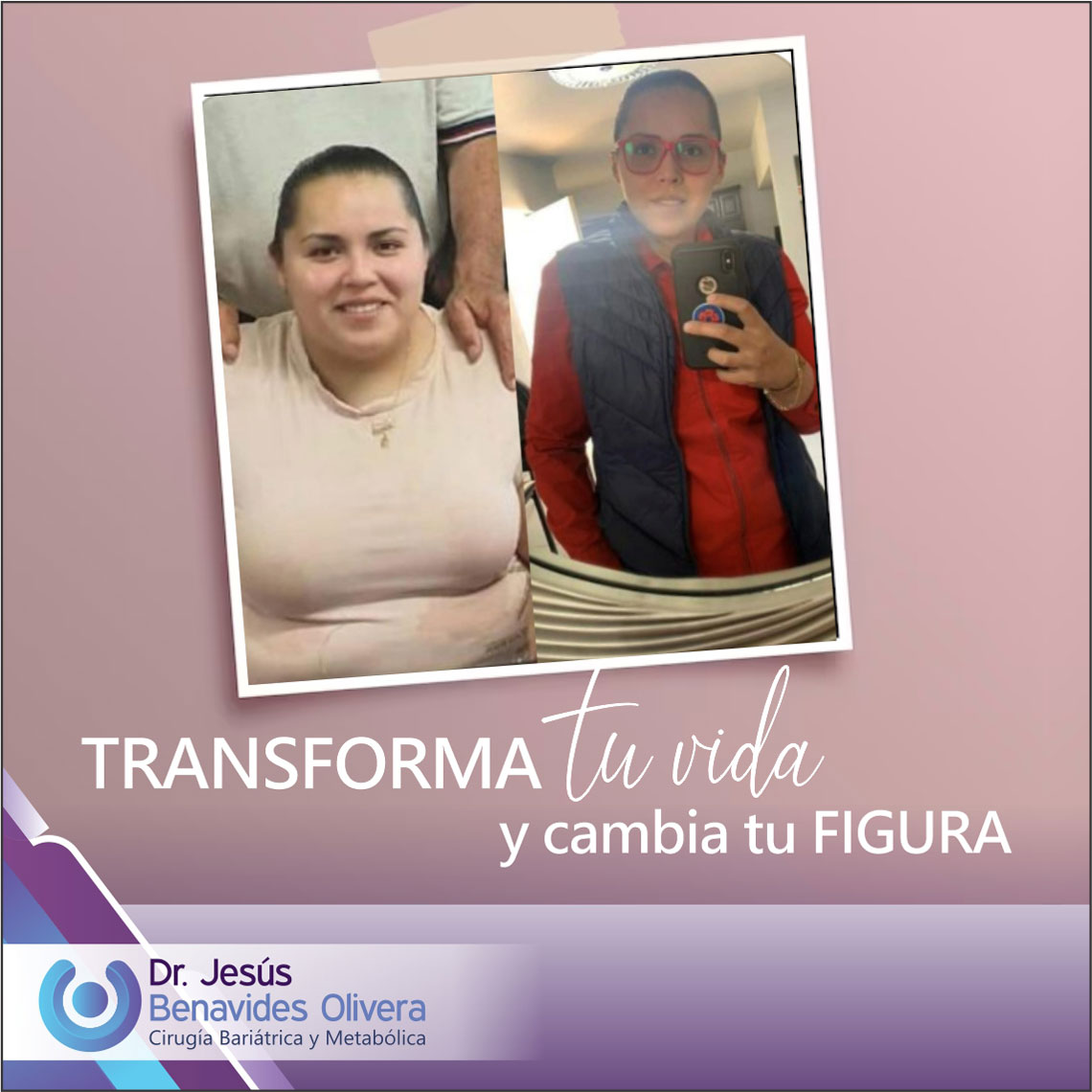 DR. JESUS BENAVIDES OLIVERA CIRUJANO BARIATRA