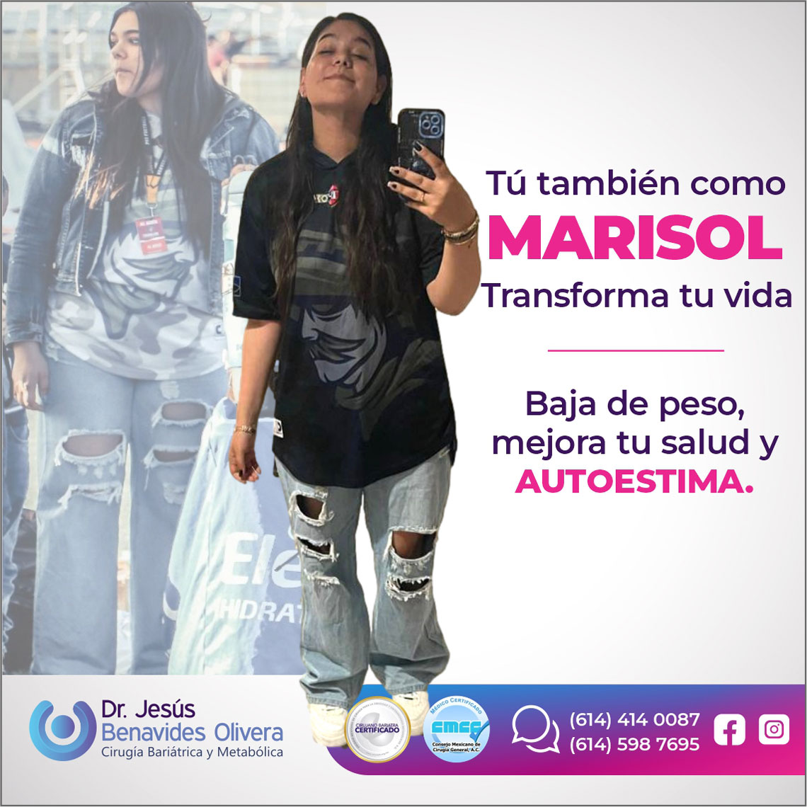 DR. JESUS BENAVIDES OLIVERA CIRUJANO BARIATRA